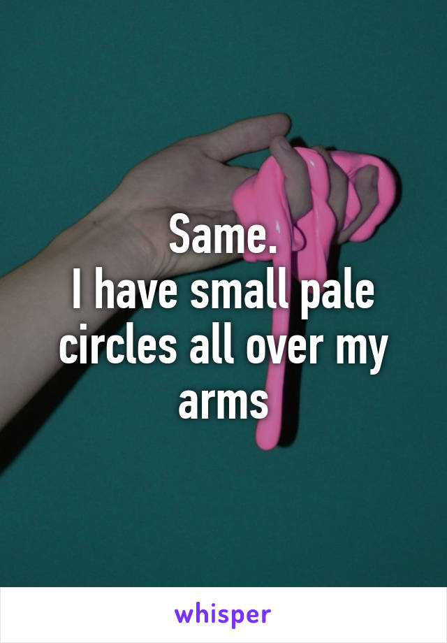 Same.
I have small pale circles all over my arms