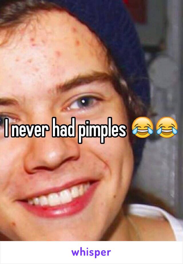 I never had pimples 😂😂