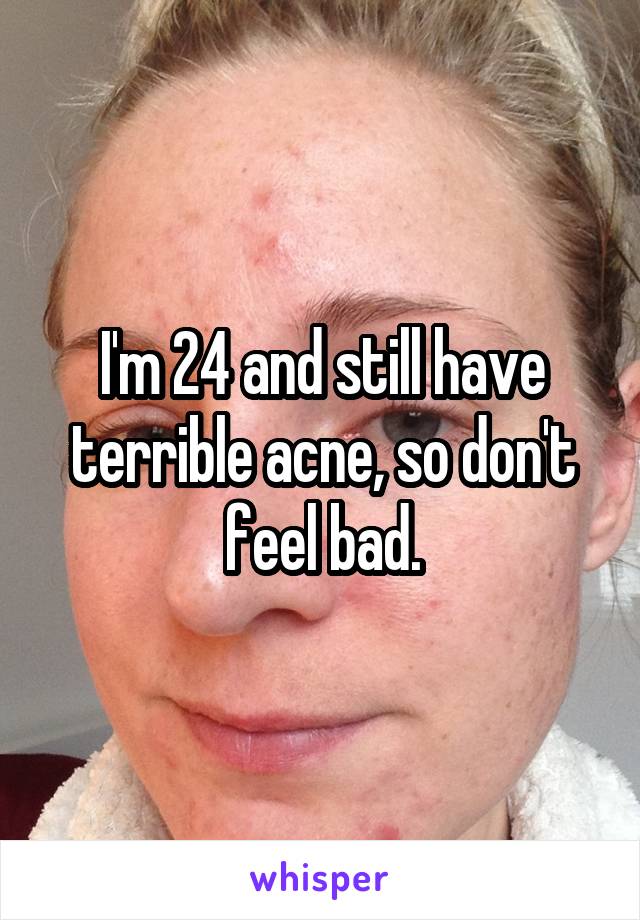 I'm 24 and still have terrible acne, so don't feel bad.