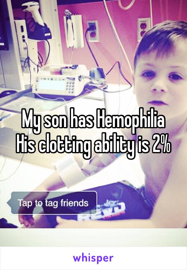 My son has Hemophilia 
His clotting ability is 2%