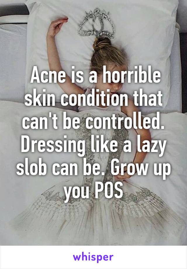  Acne is a horrible skin condition that can't be controlled. Dressing like a lazy slob can be. Grow up you POS
