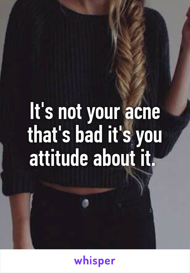 It's not your acne that's bad it's you attitude about it. 