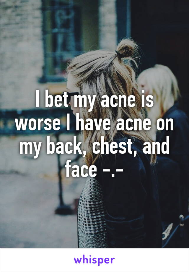 I bet my acne is worse I have acne on my back, chest, and face -.-