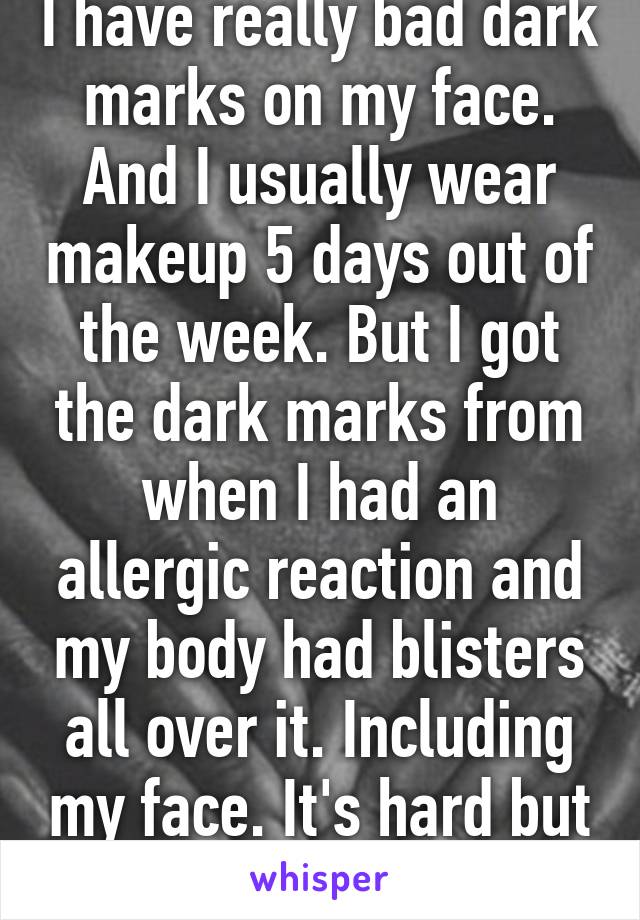 I have really bad dark marks on my face. And I usually wear makeup 5 days out of the week. But I got the dark marks from when I had an allergic reaction and my body had blisters all over it. Including my face. It's hard but doable! 