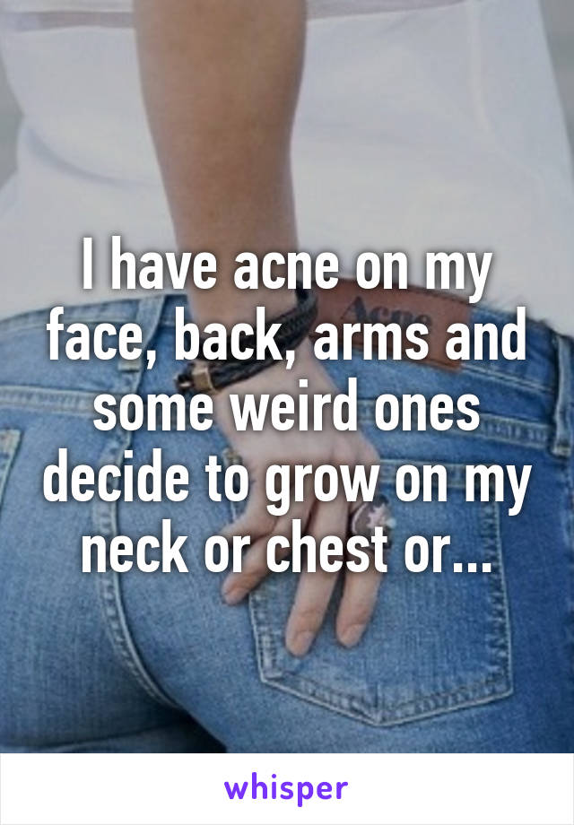 I have acne on my face, back, arms and some weird ones decide to grow on my neck or chest or...