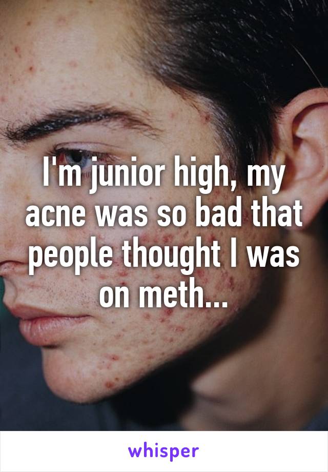 I'm junior high, my acne was so bad that people thought I was on meth...