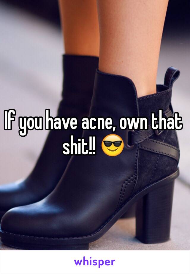 If you have acne, own that shit!! 😎