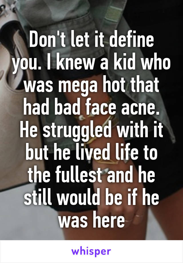 Don't let it define you. I knew a kid who was mega hot that had bad face acne. He struggled with it but he lived life to the fullest and he still would be if he was here