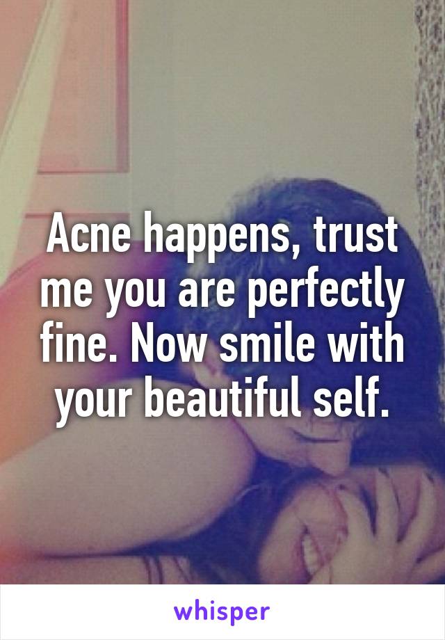 Acne happens, trust me you are perfectly fine. Now smile with your beautiful self.