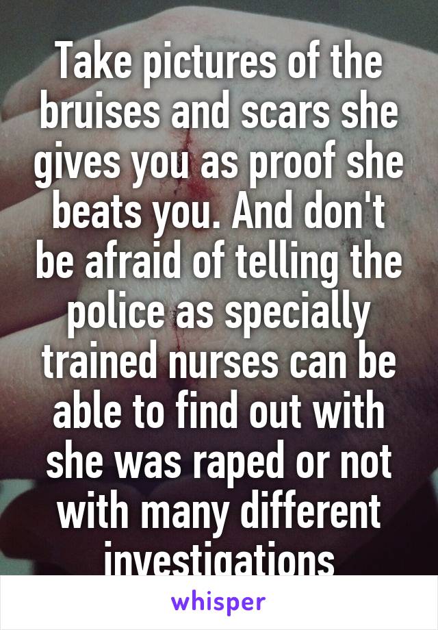 Take pictures of the bruises and scars she gives you as proof she beats you. And don't be afraid of telling the police as specially trained nurses can be able to find out with she was raped or not with many different investigations