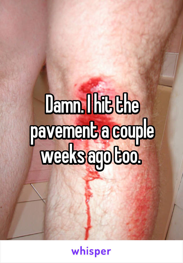 Damn. I hit the pavement a couple weeks ago too. 