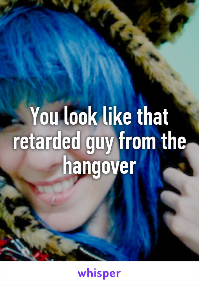 You look like that retarded guy from the hangover