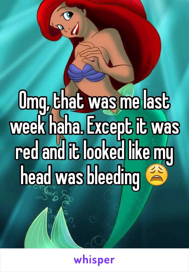 Omg, that was me last week haha. Except it was red and it looked like my head was bleeding 😩