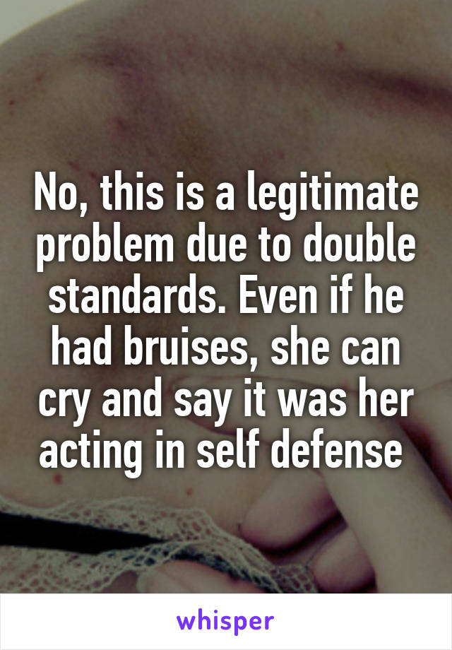 No, this is a legitimate problem due to double standards. Even if he had bruises, she can cry and say it was her acting in self defense 