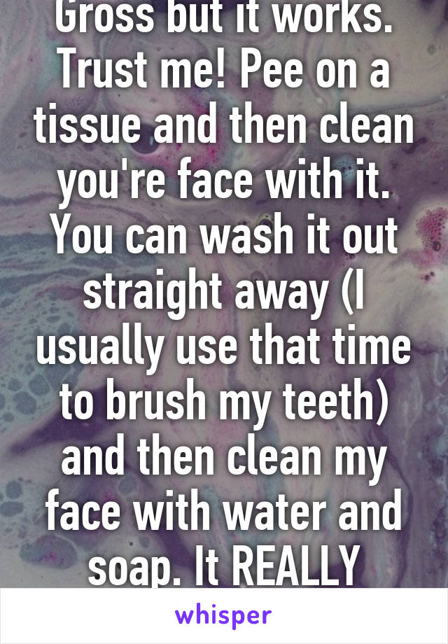 Gross but it works. Trust me! Pee on a tissue and then clean you're face with it. You can wash it out straight away (I usually use that time to brush my teeth) and then clean my face with water and soap. It REALLY works!