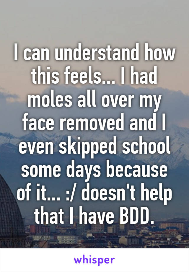 I can understand how this feels... I had moles all over my face removed and I even skipped school some days because of it... :/ doesn't help that I have BDD.