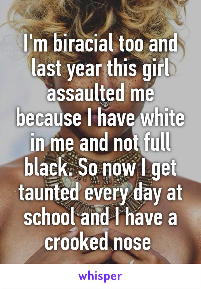 I'm biracial too and last year this girl assaulted me because I have white in me and not full black. So now I get taunted every day at school and I have a crooked nose 