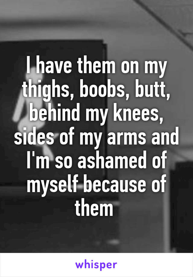 I have them on my thighs, boobs, butt, behind my knees, sides of my arms and I'm so ashamed of myself because of them 