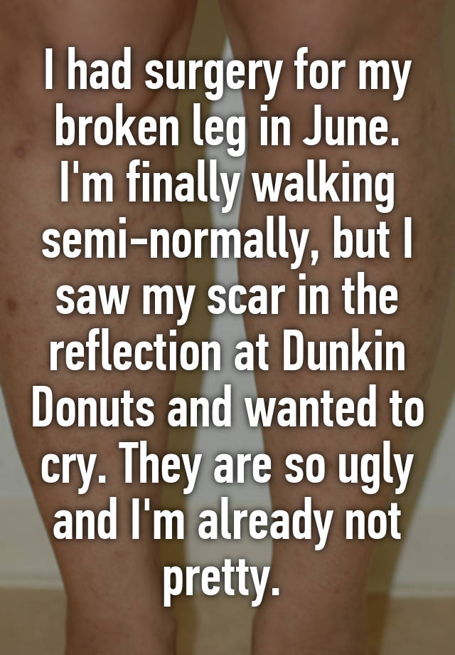 I had surgery for my broken leg in June. I'm finally walking semi-normally, but I saw my scar in the reflection at Dunkin Donuts and wanted to cry. They are so ugly and I'm already not pretty. 