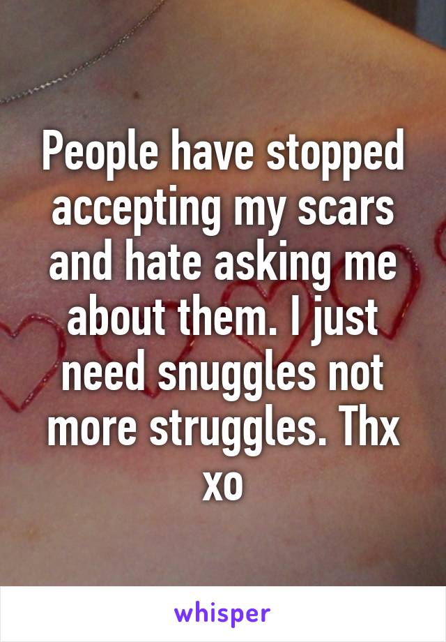 People have stopped accepting my scars and hate asking me about them. I just need snuggles not more struggles. Thx xo