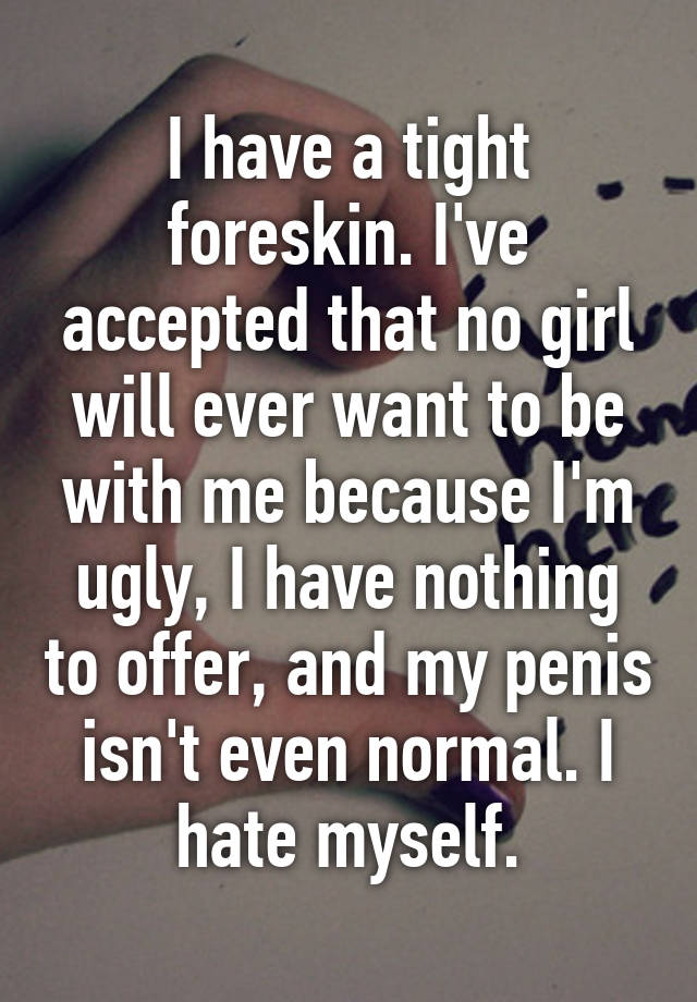 I have a tight foreskin. I've accepted that no girl will ever want to be with me because I'm ugly, I have nothing to offer, and my penis isn't even normal. I hate myself.