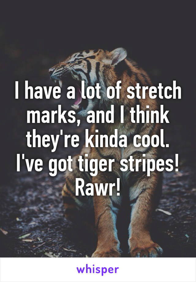 I have a lot of stretch marks, and I think they're kinda cool. I've got tiger stripes! Rawr!