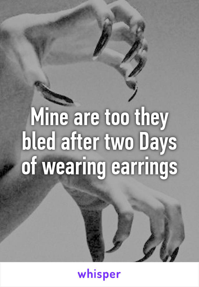 Mine are too they bled after two Days of wearing earrings