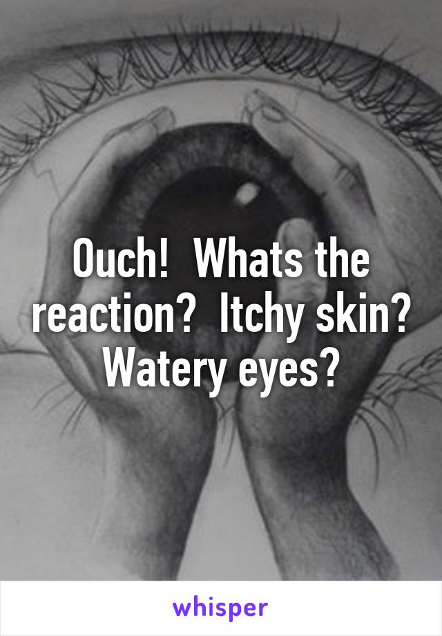 Ouch!  Whats the reaction?  Itchy skin? Watery eyes?