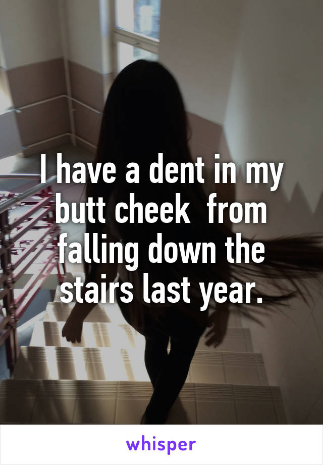 I have a dent in my butt cheek  from falling down the stairs last year.
