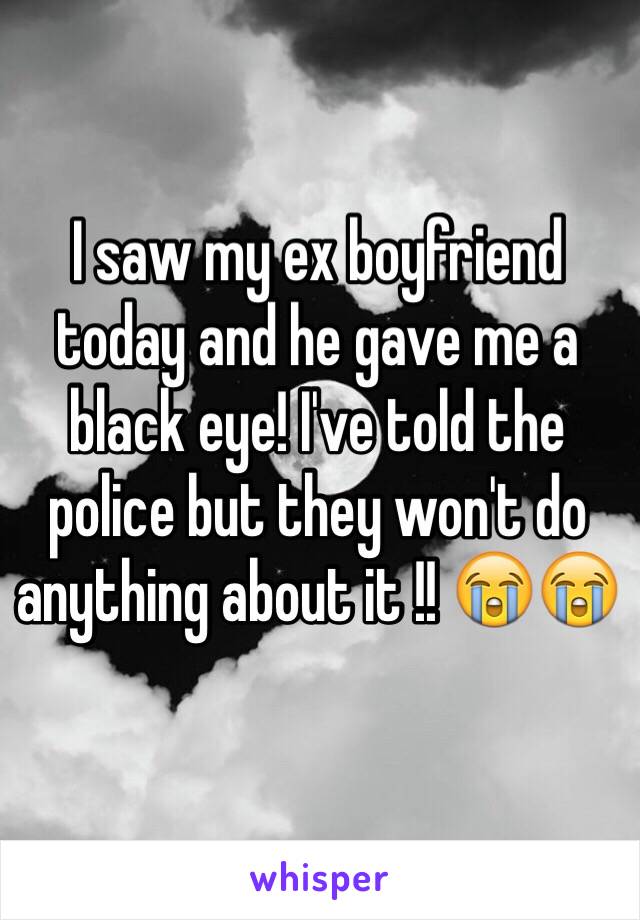 I saw my ex boyfriend today and he gave me a black eye! I've told the police but they won't do anything about it !! 😭😭