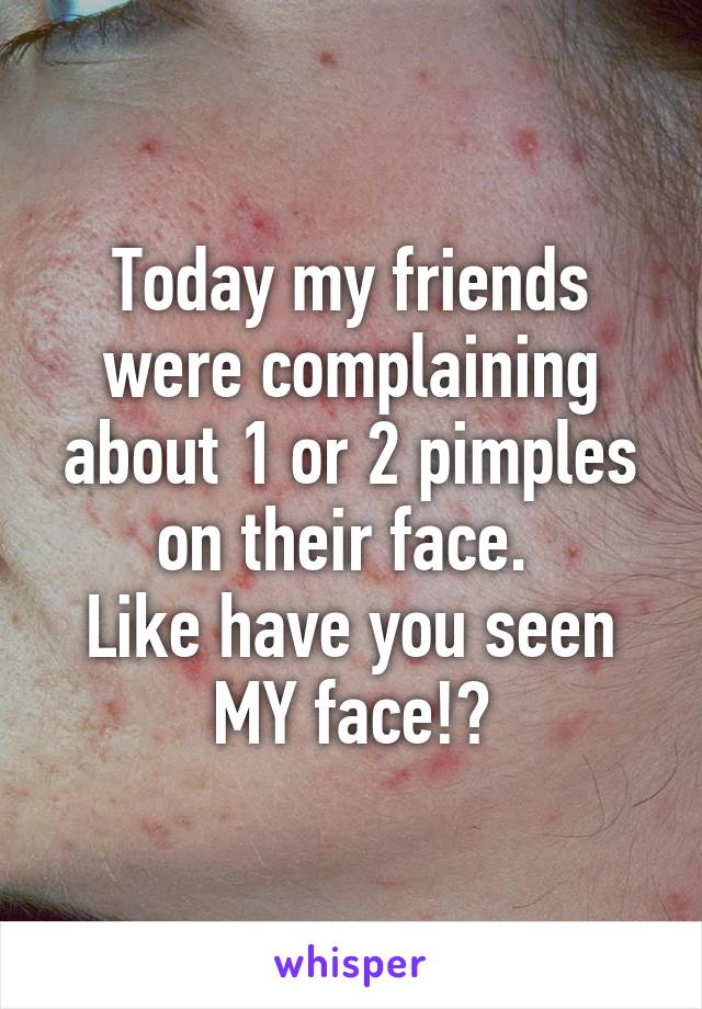 Today my friends were complaining about 1 or 2 pimples on their face. 
Like have you seen MY face!?