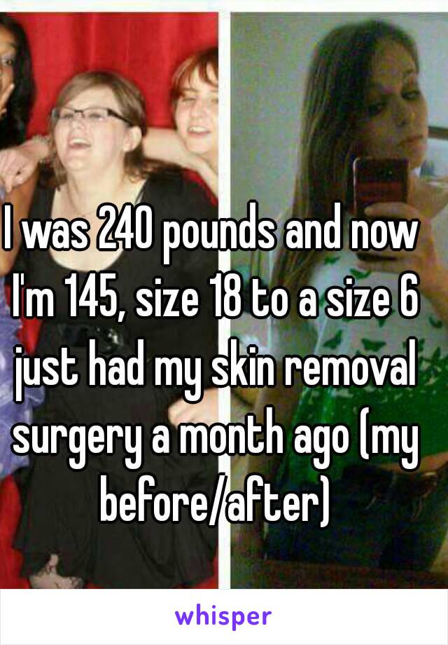 I was 240 pounds and now I'm 145, size 18 to a size 6 just had my skin removal surgery a month ago (my before/after)