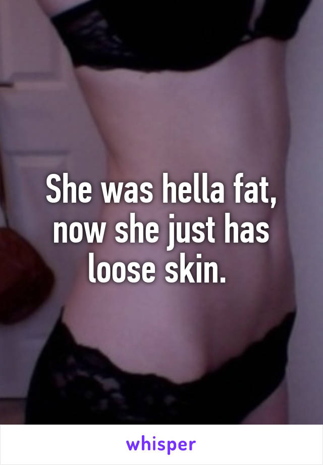 She was hella fat, now she just has loose skin. 