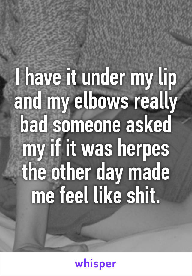 I have it under my lip and my elbows really bad someone asked my if it was herpes the other day made me feel like shit.