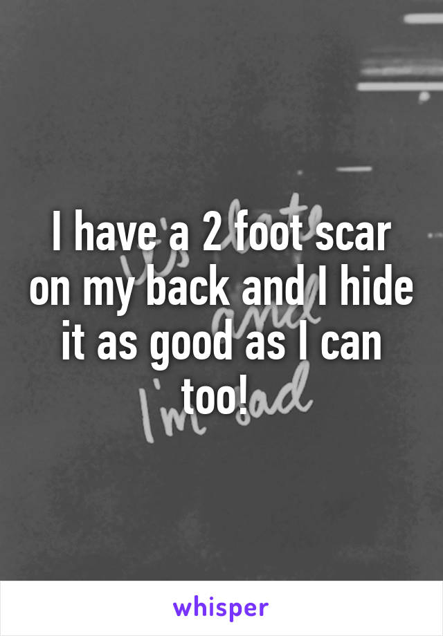 I have a 2 foot scar on my back and I hide it as good as I can too! 