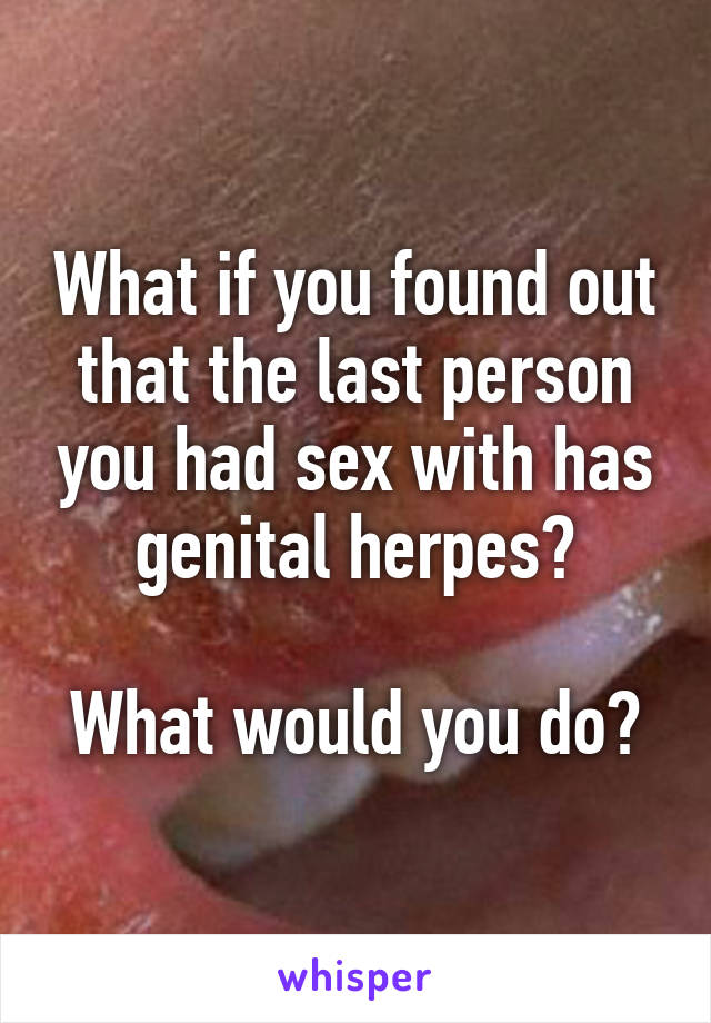 What if you found out that the last person you had sex with has genital herpes?

What would you do?