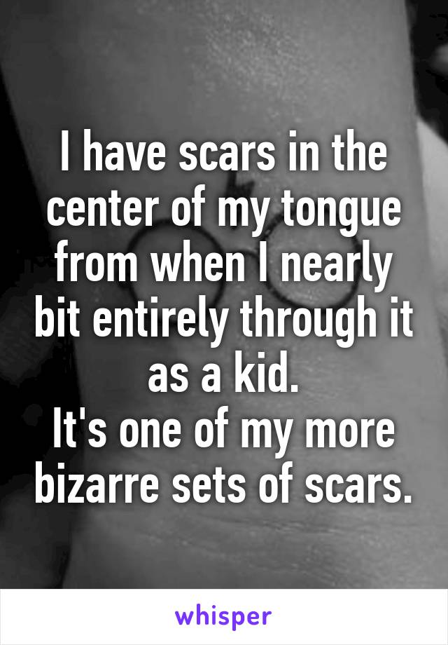 I have scars in the center of my tongue from when I nearly bit entirely through it as a kid.
It's one of my more bizarre sets of scars.