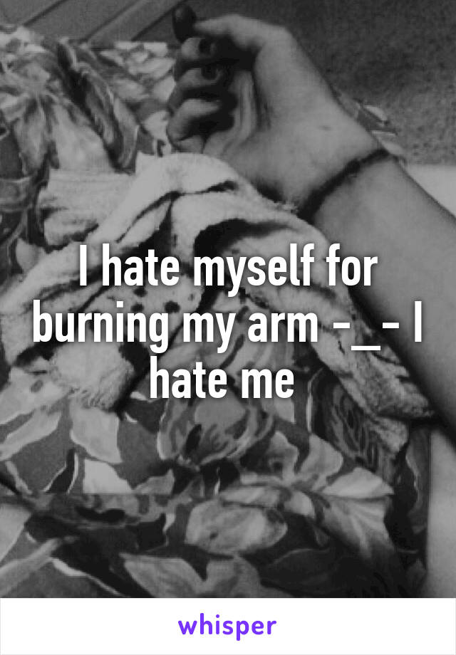 I hate myself for burning my arm -_- I hate me 