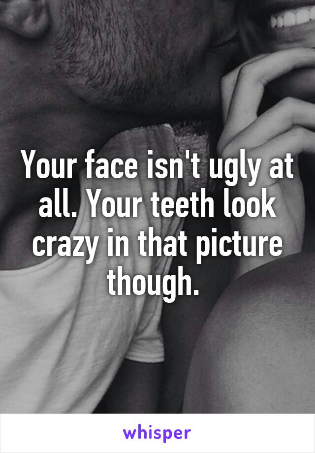 Your face isn't ugly at all. Your teeth look crazy in that picture though. 