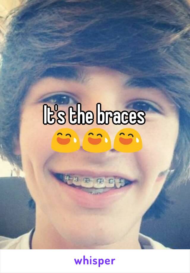 It's the braces 😅😅😅