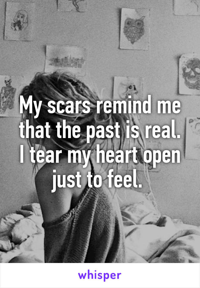 My scars remind me that the past is real.
I tear my heart open just to feel. 