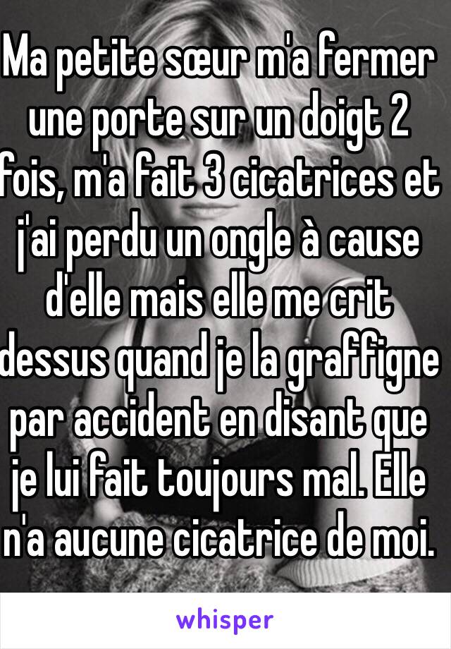 Ma petite sœur m'a fermer une porte sur un doigt 2 fois, m'a fait 3 cicatrices et j'ai perdu un ongle à cause d'elle mais elle me crit dessus quand je la graffigne par accident en disant que je lui fait toujours mal. Elle n'a aucune cicatrice de moi.