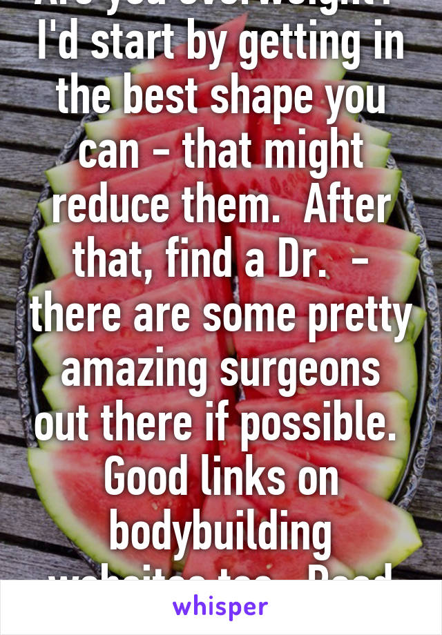 Are you overweight?  I'd start by getting in the best shape you can - that might reduce them.  After that, find a Dr.  - there are some pretty amazing surgeons out there if possible.  Good links on bodybuilding websites too.  Read forums