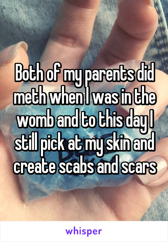 Both of my parents did meth when I was in the womb and to this day I still pick at my skin and create scabs and scars