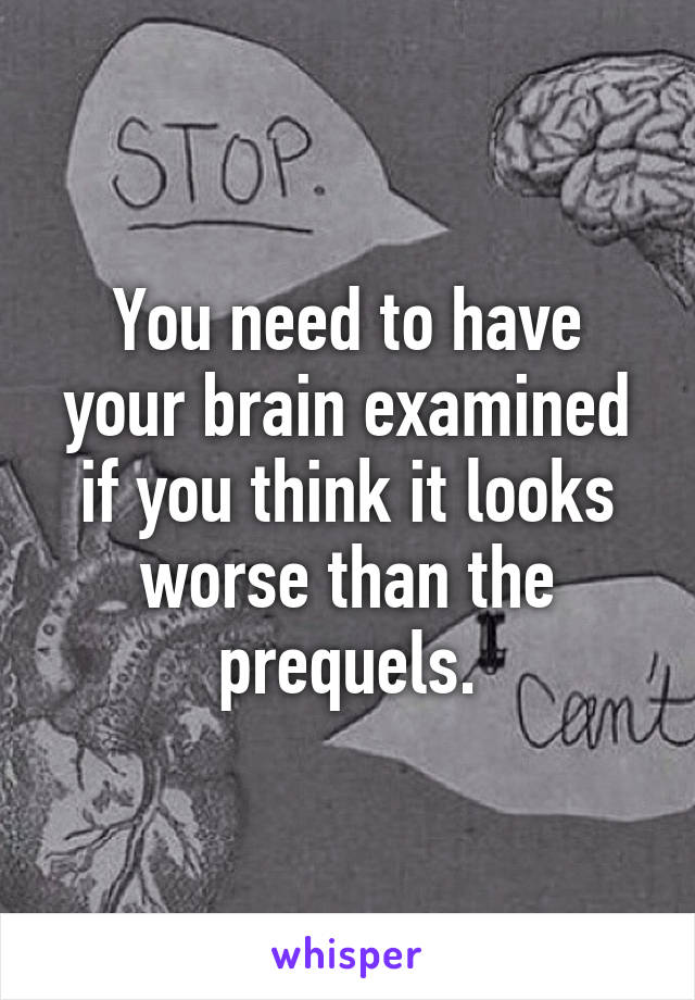 You need to have your brain examined if you think it looks worse than the prequels.