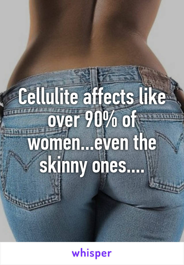 Cellulite affects like over 90% of women...even the skinny ones....