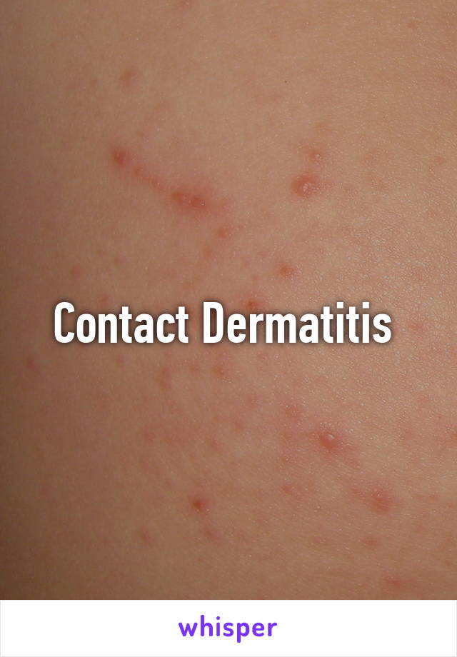 Contact Dermatitis 