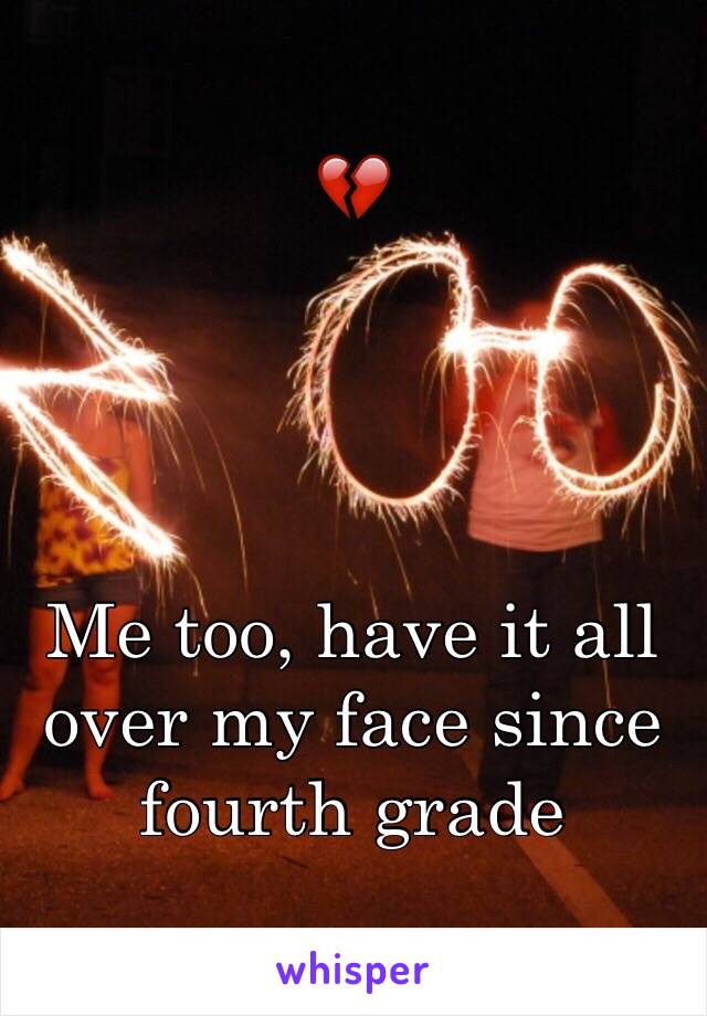 💔




Me too, have it all over my face since fourth grade