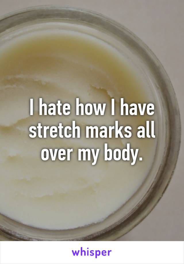I hate how I have stretch marks all over my body.