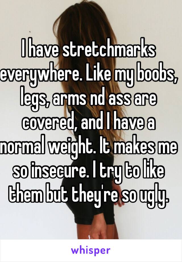 I have stretchmarks everywhere. Like my boobs, legs, arms nd ass are covered, and I have a normal weight. It makes me so insecure. I try to like them but they're so ugly. 